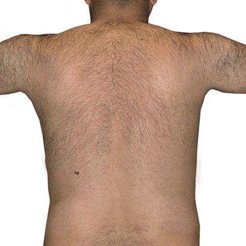 Bare back of a man with body hair.