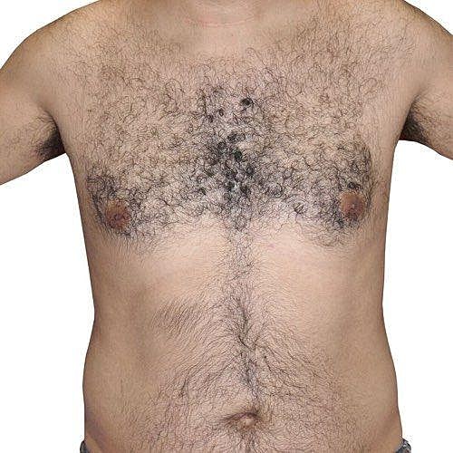 Male torso with prominent body hair.