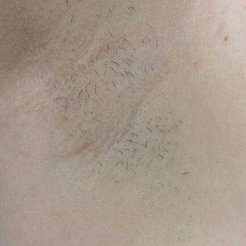 Close-up of skin with fine hair.