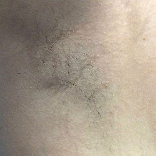 Close-up of skin with fine hair.